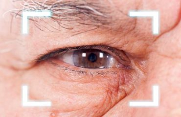 White cataract surgery in real time – topical anesthesia